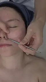 도화 올가뷰티드림 버블 모공디톡스로 모낭충박멸